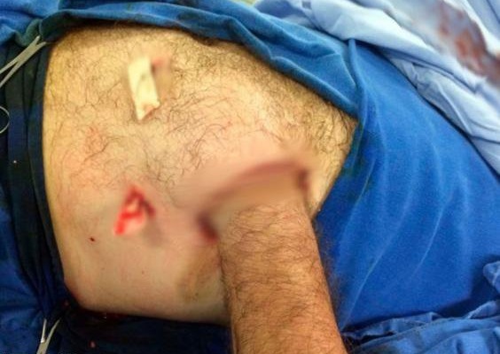یک عمل جراحی نادر در برزیل (تصاویر)