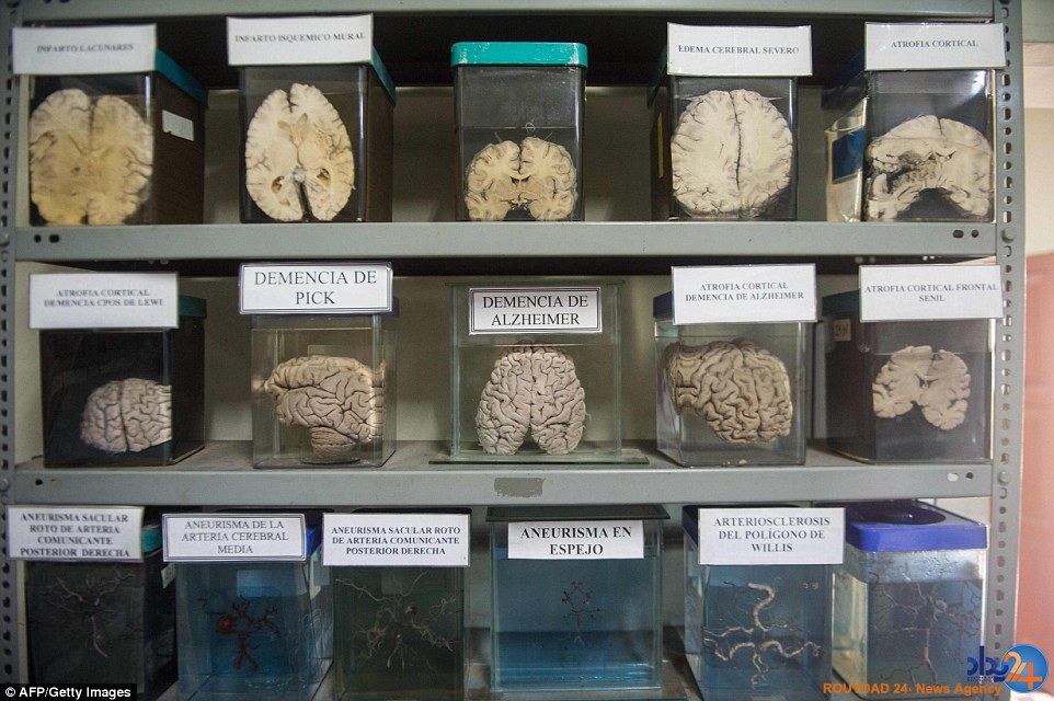 موزه‌ای با 3000 مغز که بیش از 300 سال قدمت دارد (تصاویر)