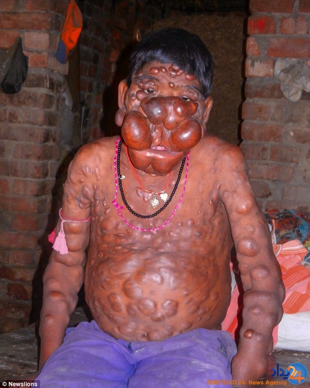 پسر نفرین شده هند (تصاویر)