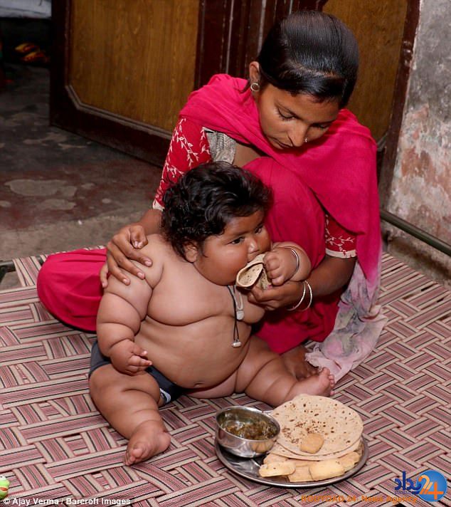 دختر 8 ماهه با 12 کیلو وزن پزشکان را گیج کرده است (تصاویر)
