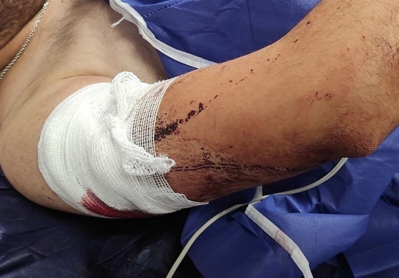 حمله هولناک خفتگیرها به یک جوان | یک دانشجوی دیگر قربانی شد حمله هولناک خفتگیرها به یک جوان | یک دانشجوی دیگر قربانی شد